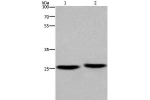 Western Blot analysis of Mouse brain and Human fetal muscle tissue using EPDR1 Polyclonal Antibody at dilution of 1:850 (EPDR1 抗体)