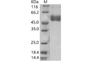 Western Blotting (WB) image for West Nile Virus NS1 (WNV NS1) protein (His tag) (ABIN7198746) (WNV NS1 Protein (His tag))