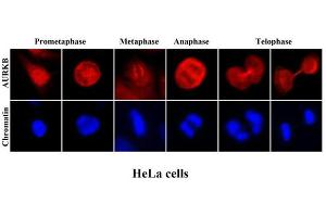 Immunofluorescenitrocellulosee of human HeLa cells stained with Hoechst 3342 (Blue) for chromatin staining and monoclonal anti-human Aurora kinase B antibody (1:2000) with Texas Red (Red). (Aurora Kinase B 抗体  (AA 1-344))