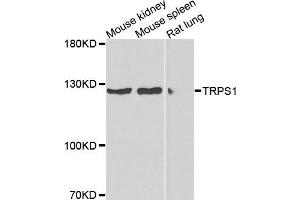 Western blot analysis of extracts of various cells, using TRPS1 antibody. (TRPS1 抗体)