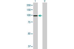 Western Blotting (WB) image for anti-ATPase, Ca++ Transporting, Type 2C, Member 1 (ATP2C1) (AA 1-919) antibody (ABIN525805)