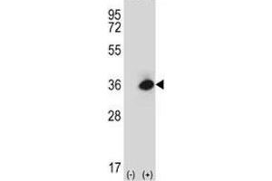 Western Blotting (WB) image for anti-Advanced Glycosylation End Product-Specific Receptor (AGER) (AA 76-104) antibody (ABIN3029883)