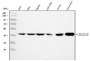 Western blot analysis of SUCLG2 using anti-SUCLG2 antibody (ABIN7601694).