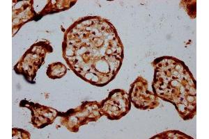 Immunohistochemistry (IHC) image for anti-STT3, Subunit of The Oligosaccharyltransferase Complex, Homolog B (STT3B) (AA 682-809) antibody (ABIN7150607)