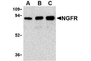 Western Blotting (WB) image for anti-Nerve Growth Factor Receptor (NGFR) antibody (ABIN2479591) (NGFR 抗体)