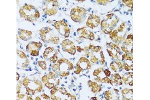 Immunohistochemistry of paraffin-embedded Human stomach using C1QC Polyclonal Antibody at dilution of 1:100 (40x lens). (C1QC 抗体)