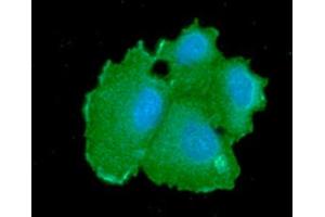 ICC/IF analysis of CBR1 in Hep3B cells line, stained with DAPI (Blue) for nucleus staining and monoclonal anti-CBR1 antibody (1:100) with goat anti-mouse IgG-Alexa fluor 488 conjugate (Green). (CBR1 抗体  (AA 1-277))
