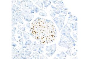 Immunohistochemistry (IHC) image for anti-Transcription Factor MafA (MAFA) (AA 125-175) antibody (ABIN7449538)