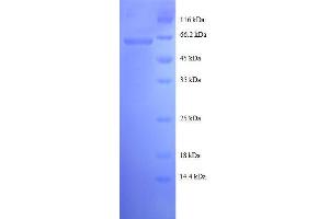 SDS-PAGE (SDS) image for Malate Dehydrogenase 1, NAD (Soluble) (MDH1) (AA 2-333), (full length) protein (GST tag) (ABIN1095677)