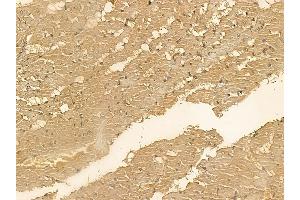 SMAP2 Mouse Monoclonal Antibody at 1/100 staining rat heart tissue by IHC-P. (SMAP2 抗体)
