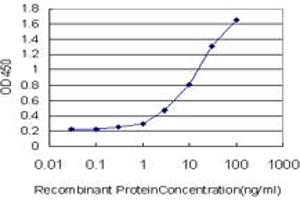 Detection limit for recombinant GST tagged DBF4 is approximately 0. (DBF4 抗体  (AA 2-98))