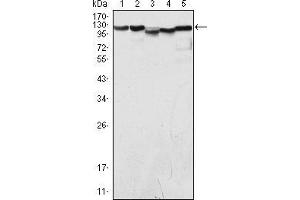Western blot analysis using LSD1 mouse mAb against COS (1), Hela (2), NIH/3T3 (3), A549 (4) and Jurkat (5) cell lysate. (LSD1 抗体)