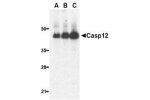 Western blot analysis of caspase-12 in human heart lysate with AP30192PU-N caspase-12 antibody (large) at 0. (Caspase 12 抗体  (large))