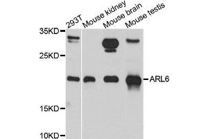 Western blot analysis of extracts of various cell lines, using ARL6 antibody. (ARL6 抗体  (AA 1-186))