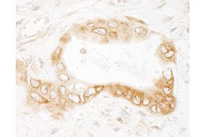 Immunohistochemistry (IHC) image for anti-UV Radiation Resistance Associated Gene (UVRAG) (AA 649-699) antibody (ABIN7453808)