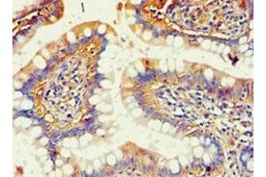 Immunohistochemistry (IHC) image for anti-Aldo-Keto Reductase Family 1, Member B1 (Aldose Reductase) (AKR1B1) (AA 1-316) antibody (ABIN7143685)