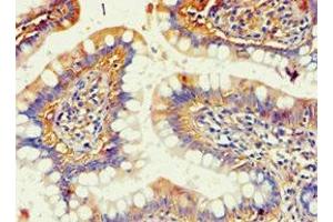 Immunohistochemistry of paraffin-embedded human small intestine tissue using ABIN7143685 at dilution of 1:100 (AKR1B1 抗体  (AA 1-316))