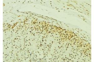 ABIN6277054 at 1/100 staining Human gastric tissue by IHC-P. (IKK alpha 抗体  (N-Term))
