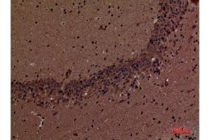 Immunohistochemistry (IHC) analysis of paraffin-embedded Mouse Brain, antibody was diluted at 1:100. (INPPL1 抗体  (Internal Region))