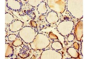 Immunohistochemistry of paraffin-embedded human thyroid tissue using ABIN7146159 at dilution of 1:100 (C2CD3 抗体  (AA 2079-2265))