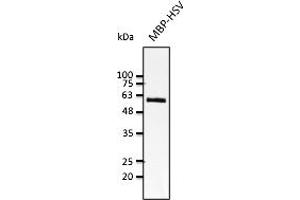 Western Blotting (WB) image for anti-HSV Tag antibody (ABIN7272989) (HSV Tag 抗体)