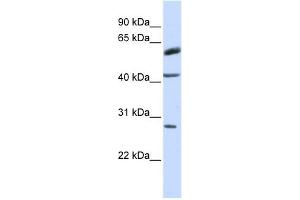 RNF170 antibody used at 1 ug/ml to detect target protein. (RNF170 抗体  (Middle Region))