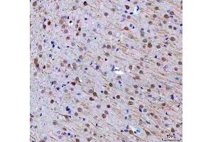 IHC analysis of RTF1 using anti-RTF1 antibody (ABIN7602444). (RTF1 抗体  (AA 77-705))