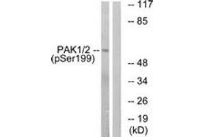 Western blot analysis of extracts from LOVO cells treated with starved 24h, using PAK1 (Phospho-Ser199) Antibody. (PAK1 抗体  (pSer199))