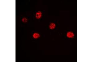 Immunofluorescent analysis of MYF5 staining in Jurkat cells. (MYF5 抗体  (Center))