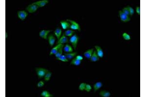 Immunofluorescence staining of Hela cells with ABIN7153969 at 1:100, counter-stained with DAPI. (GRIK1 抗体  (AA 675-834))