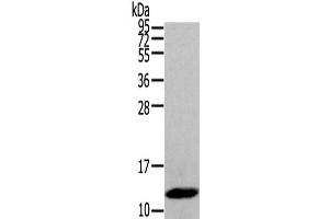 Western Blot analysis of Human placenta tissue using DEFB112 Polyclonal Antibody at dilution of 1/200 (DEFB112 抗体)