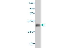 Western Blot detection against Immunogen (36. (PFN2 抗体  (AA 41-140))