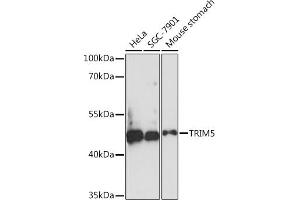 Western blot analysis of extracts of various cell lines, using TRIM5 Rabbit pAb (ABIN7270992) at 1:1000 dilution. (TRIM5 抗体  (AA 100-200))
