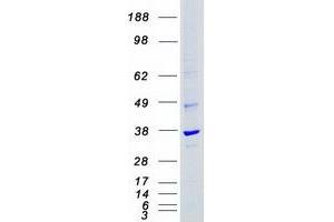 Western Blotting (WB) image for Cyclin-Dependent Kinase 4 (CDK4) protein (Myc-DYKDDDDK Tag) (ABIN2713864)