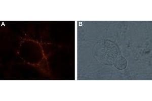 Expression of kainate receptor GluK1 in rat DRG neurons - Cell surface detection of kainate receptor GluK1 in living rat dorsal root ganglion (DRG). (GRIK1 抗体  (Extracellular))