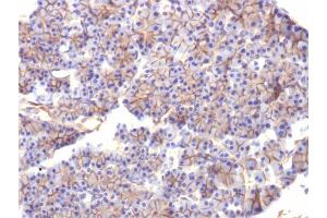Immunohistochemistry (IHC) image for anti-Spectrin, Beta, Non-erythrocytic 2 (SPTBN2) (AA 356-475) antibody (ABIN6940653)