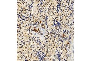 Immunohistochemistry of paraffin embedded mouse spleen using CCRL2 (ABIN7073461) at dilution of 1:300 (400x lens) (CCRL2 抗体)