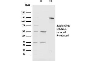 SDS-PAGE Analysis of Purified BMI1-Monospecific Mouse Monoclonal Antibody (BMI1/2689).