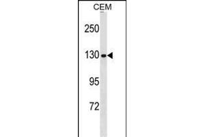 NCG Antibody (N-term) 19113a western blot analysis in CEM cell line lysates (35 μg/lane). (NCAPG 抗体  (N-Term))