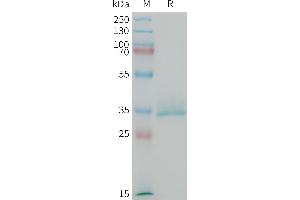 Mouse CGRP Protein, hFc Tag on SDS-PAGE under reducing condition.