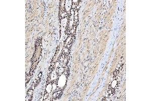 IHC analysis of SNRNP200 using anti-SNRNP200 antibody (ABIN7602032). (SNRNP200 抗体  (AA 557-2129))