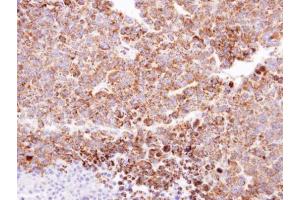 Immunohistochemistry (IHC) image for anti-ClpP Caseinolytic Peptidase, ATP-Dependent, Proteolytic Subunit Homolog (E. Coli) (CLPP) (C-Term) antibody (ABIN2855887)