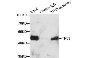 Immunoprecipitation analysis of 150ug extracts of A549 cells using 3ug TP53 antibody. (p53 抗体  (AA 1-100))