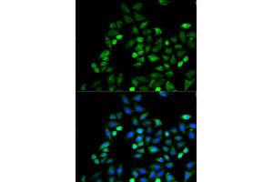Immunofluorescence analysis of HeLa cells using CD274 antibody (ABIN5997392). (PD-L1 抗体)
