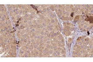 Immunohistochemistry (IHC) image for anti-Glycyl-tRNA Synthetase (GARS) (C-Term) antibody (ABIN6261883)