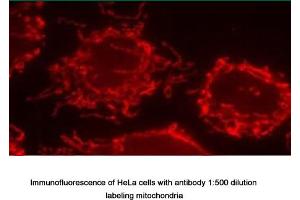 Image no. 1 for anti-Inner Membrane Protein, Mitochondrial (IMMT) antibody (ABIN363364) (IMMT 抗体)