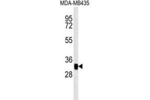 Western Blotting (WB) image for anti-Mitochondrial Carrier 2 (MTCH2) antibody (ABIN3002367) (MTCH2 抗体)