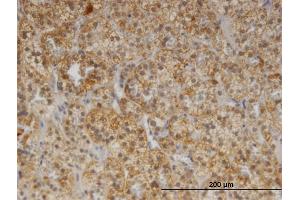 Immunostaining (ISt) image for anti-Cerebellar Degeneration-Related Protein 2, 62kDa (CDR2) (AA 296-404) antibody (ABIN514314)