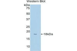 Western Blotting (WB) image for anti-Cytochrome P450, Family 1, Subfamily B, Polypeptide 1 (CYP1B1) (AA 374-516) antibody (ABIN7435466)