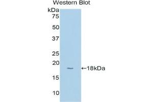 Detection of Recombinant CYP1B1, Human using Polyclonal Antibody to Cytochrome P450 1B1 (CYP1B1) (CYP1B1 抗体  (AA 374-516))